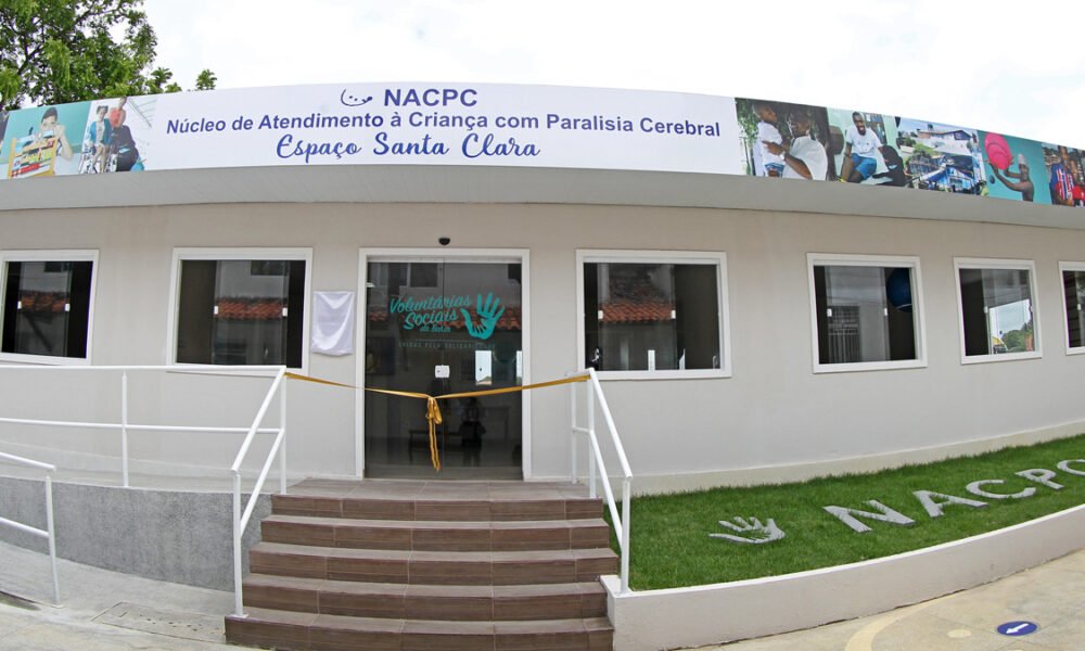 Voluntárias Sociais inauguram novo espaço do NACPC para tratamento de paralisia cerebral