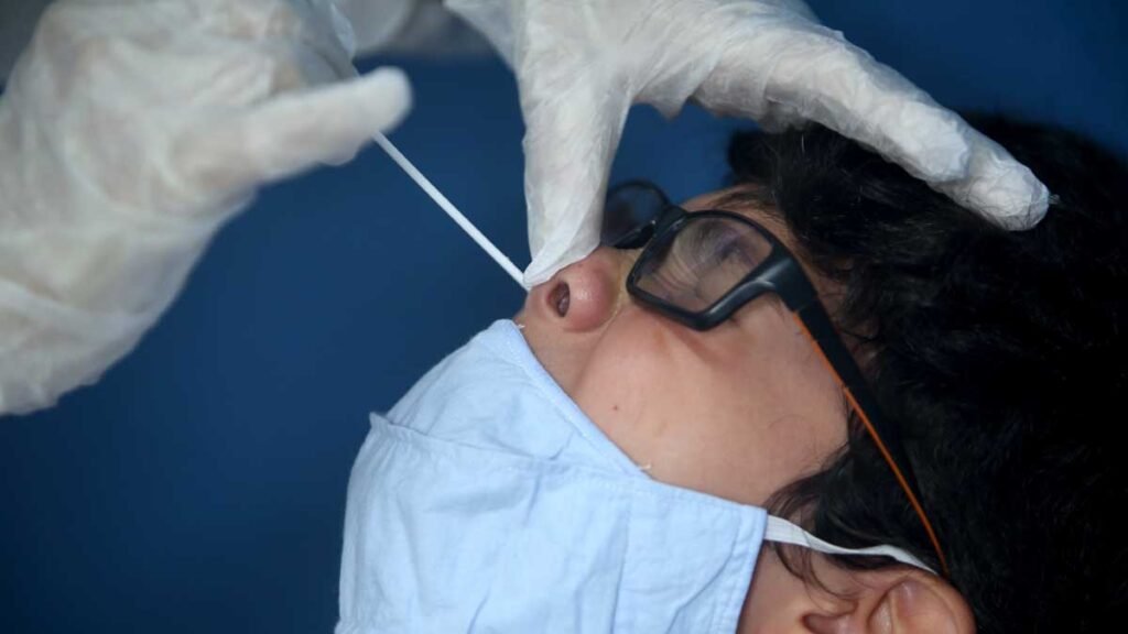 Em meio ao aumento de casos no Brasil, um total de 6,86 milhões de testes para o diagnóstico do novo coronavírus comprados pelo Ministério da Saúde estão prestes a perder a validade entre dezembro deste ano e janeiro de 2021.