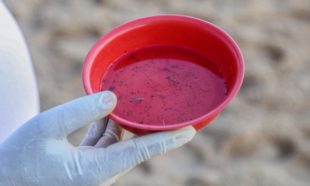 A Secretaria da Saúde do Estado da Bahia (Sesab) registrou, no primeiro semestre de 2023, um aumento de 168% nas formas graves da dengue em