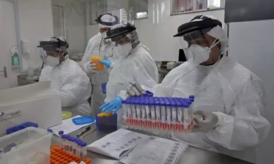 A Secretaria da Saúde do Estado da Bahia (Sesab) identificou pacientes que testaram positivo para a Covid-19 em laboratórios das redes Sabin, LPC e