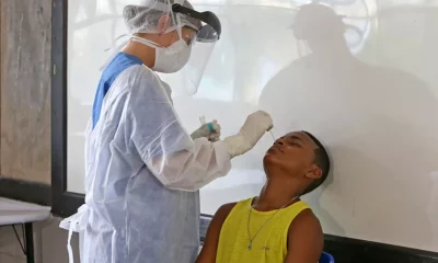 induz alterações de memória. Essas mudanças ocorrem de forma tardia, em torno de 20 a 30 dias após a infecção, tal como acontece com seres hu