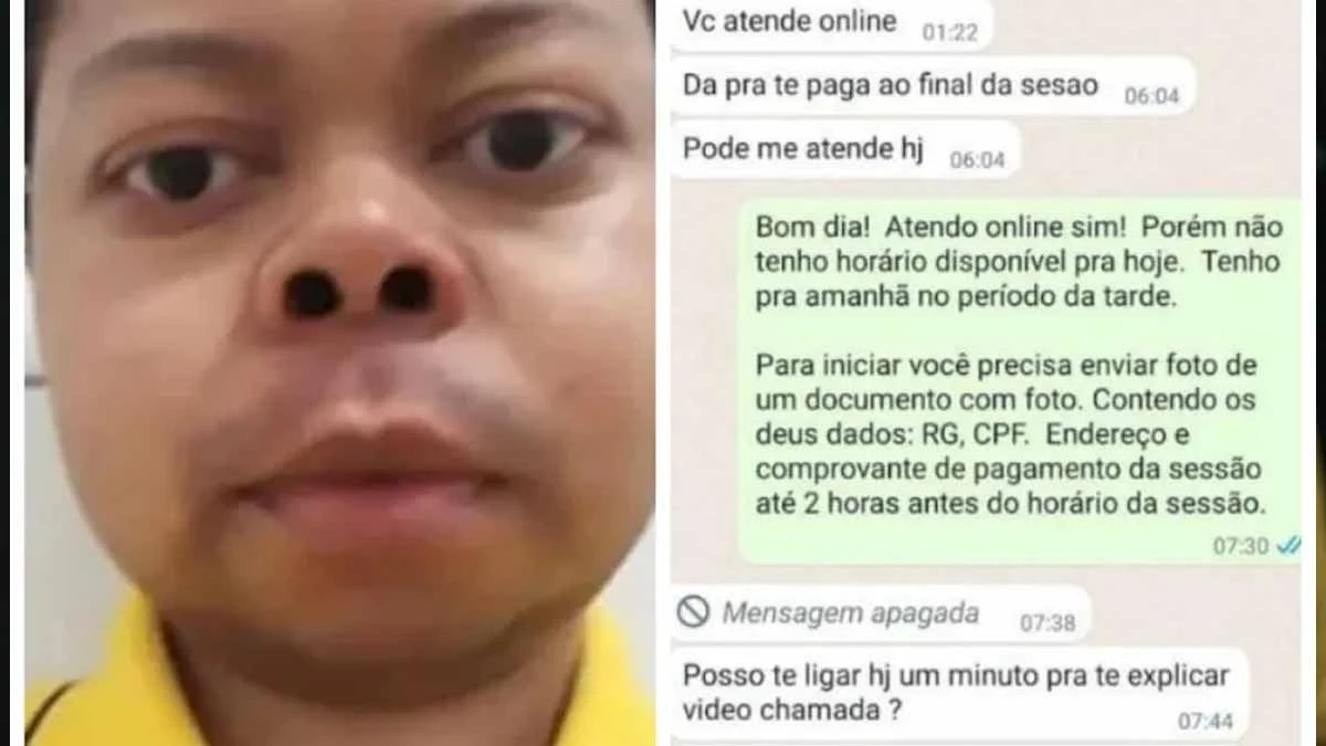 Mais de 70 psicólogas denunciaram um homem que se passava por paciente e assediava as profissionais durante consultas on-line. As mulheres relataram terem sido vítimas do sujeito, que se apresenta como Lucas Silva Dornelles, de 34 anos, e moraria no Rio Grande do Sul, e ele já chegou a se masturbar em algumas das consultas.