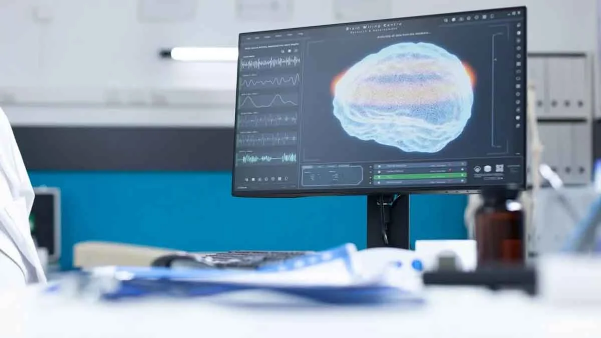 eca, com a participação de outros cientistas, desenvolveu uma pesquisa sobre o diagnóstico precoce de Parkinson por inteligência artificial.